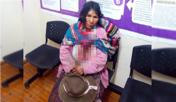 Valiente madre camina 6 horas para denunciar brutal golpiza que le dio su esposo